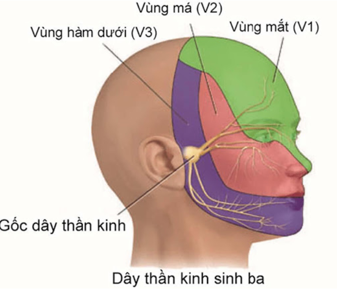 Đau dây thần kinh tam thoa là gì? Nguyên nhân gây bệnh và nguyên tắc phòng ngừa