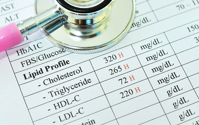 Rối loạn lipid máu