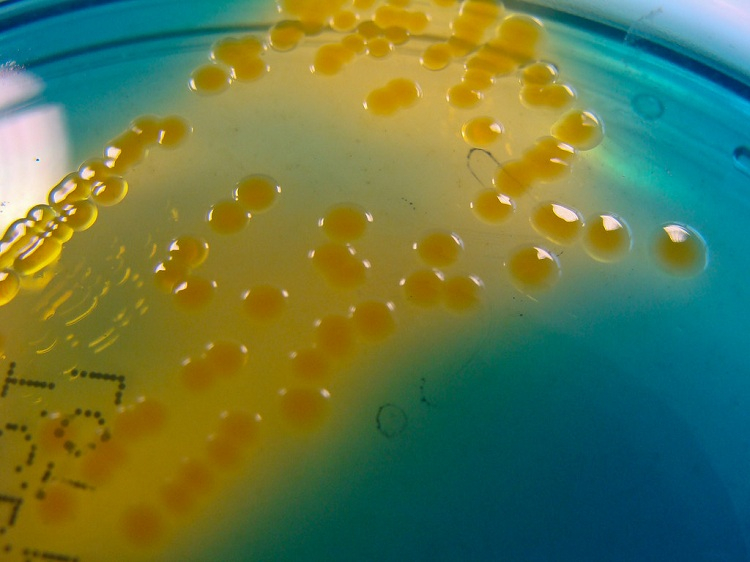 Tả do virus Vibrio Cholerae