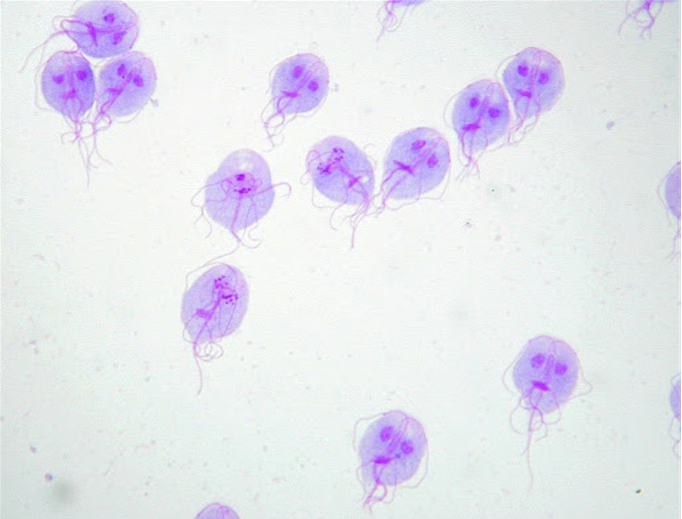 Viêm ruột do Giardia