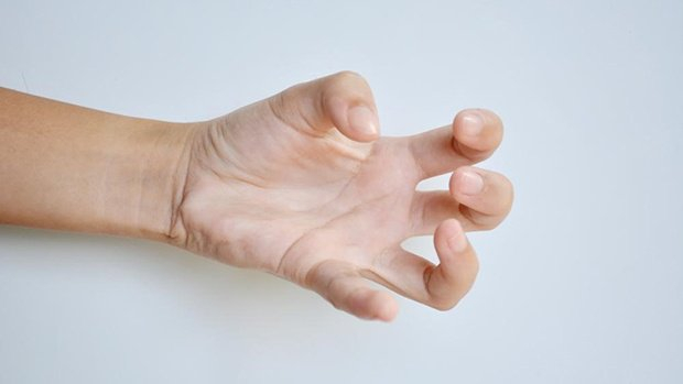 Loạn trương lực cơ