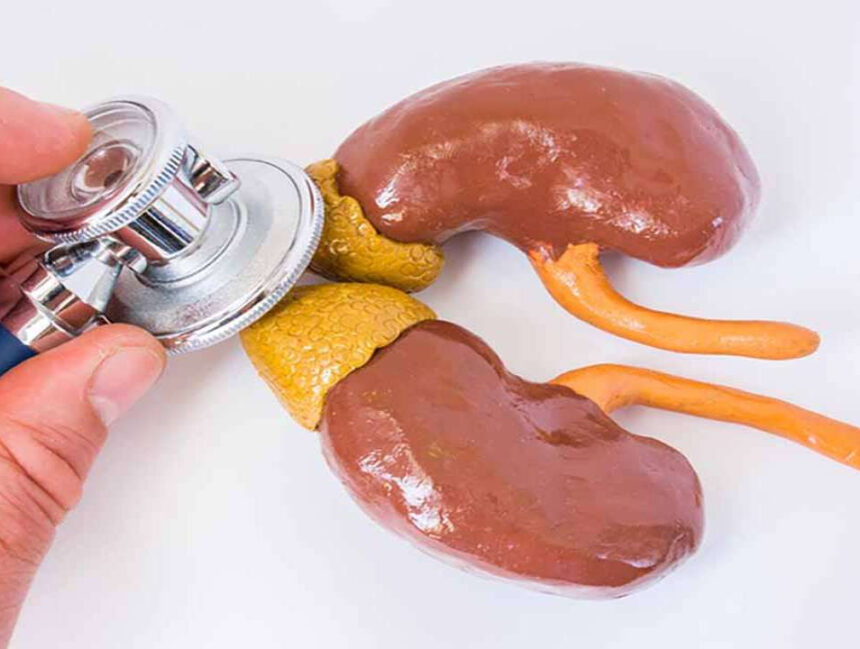 Hội chứng Cushing là gì? Nguyên nhân gây bệnh và phương pháp phòng ngừa