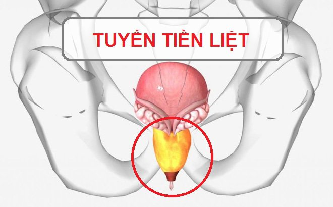 Ung thư tuyến tiền liệt là gì? Nguyên nhân do đâu?