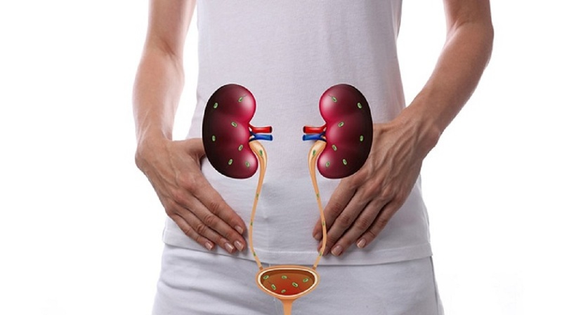 Nhiễm trùng tiết niệu