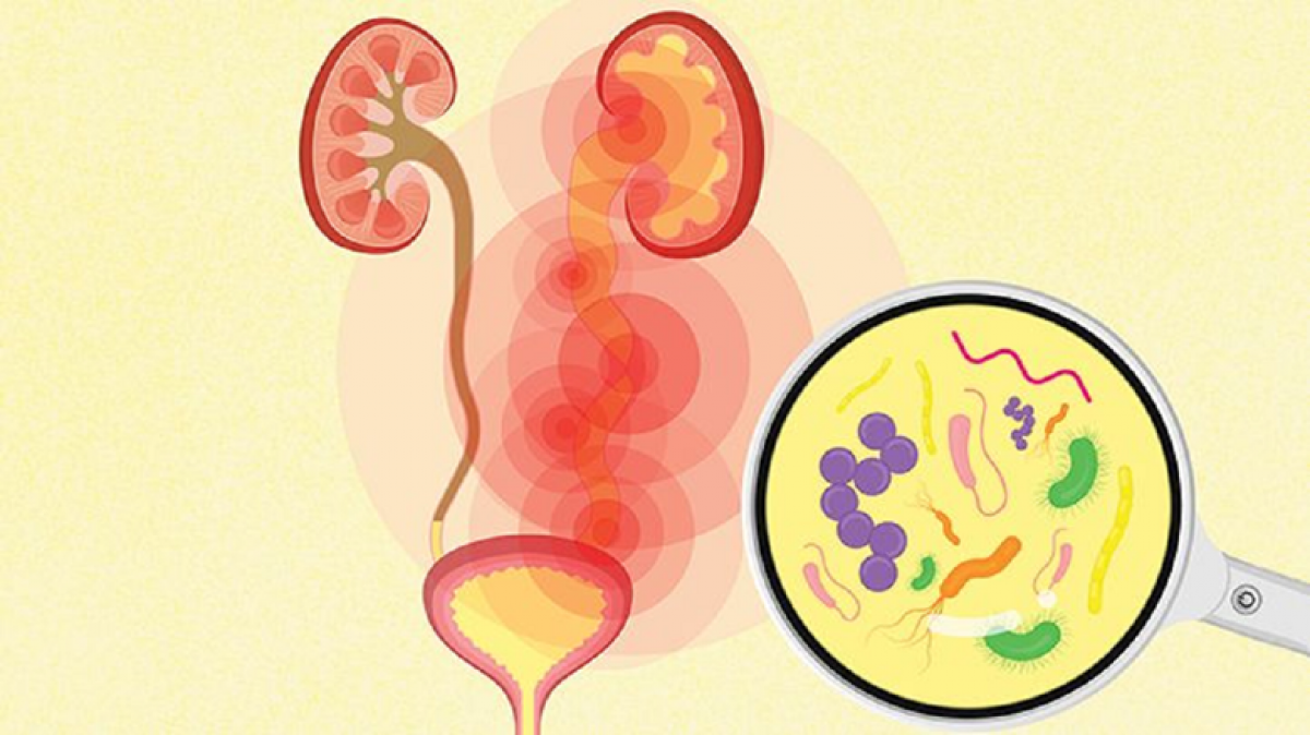 Nhiễm trùng tiết niệu