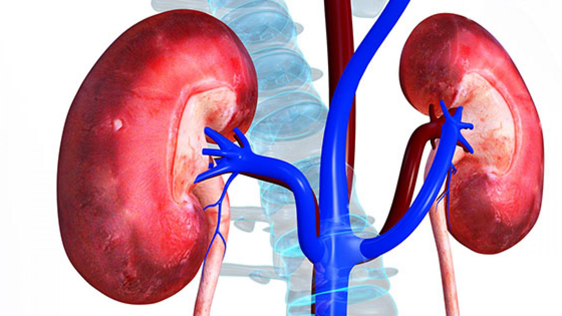 Thận ứ mủ là gì? Nguyên nhân gây bệnh và nguyên tắc phòng ngừa