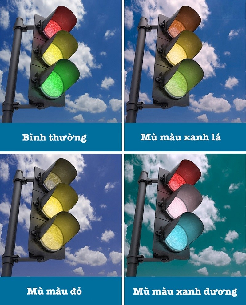 Mù màu là gì? Nguyên nhân và cách khắc phục
