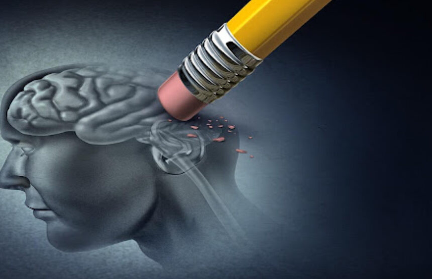 Alzheimer là gì? Tại sao lại mắc bệnh Alzheimer?
