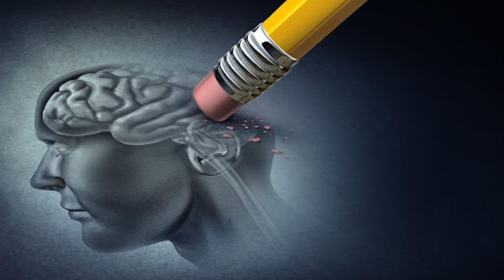 Alzheimer là gì? Tại sao lại mắc bệnh Alzheimer?