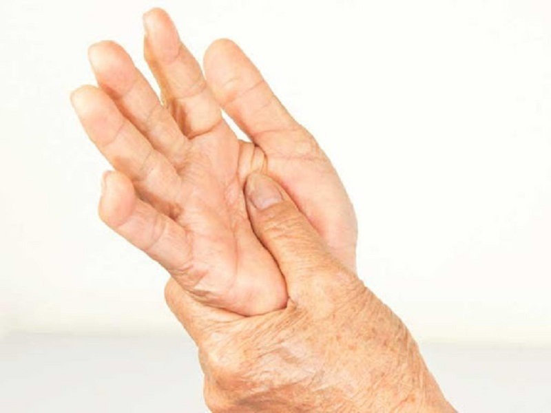 Lupus ban đỏ