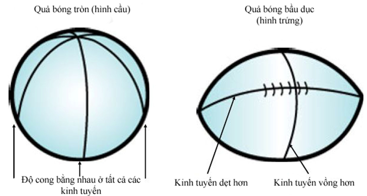 Loạn thị: Một loại tật khúc xạ phổ biến