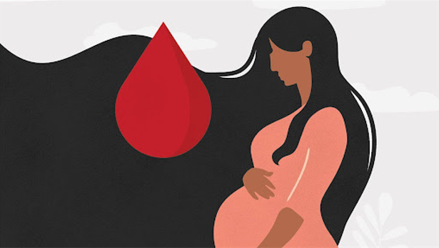 Băng huyết sau sinh: Nguyên nhân gây tử vong ở sản phụ