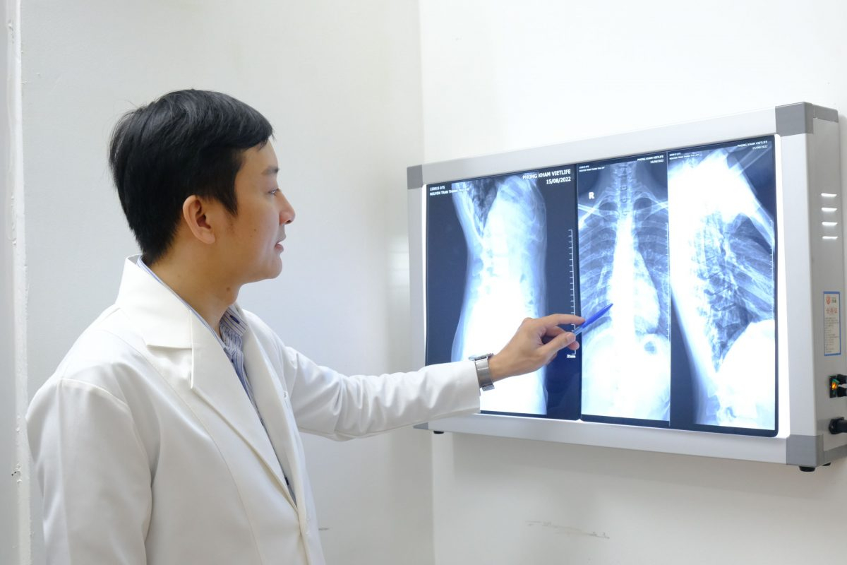 Cong vẹo cột sống