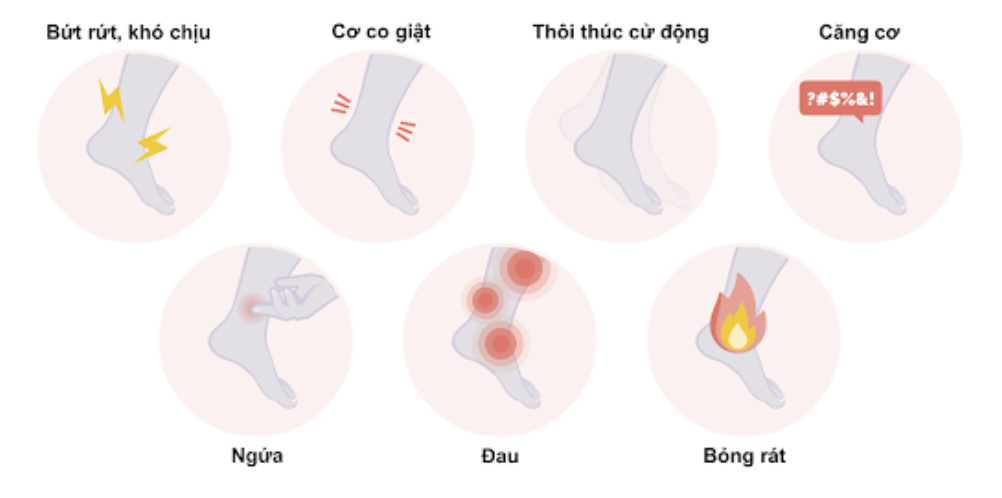 Hội chứng chân không nghỉ