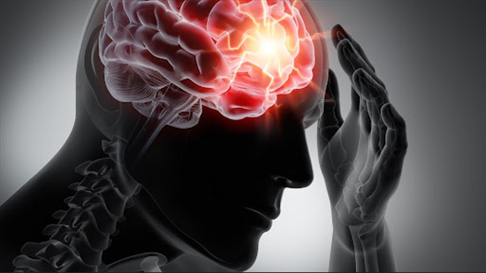 Chấn thương sọ não là gì? Nguyên nhân gây bệnh, phương pháp điều trị và nguyên tắc phòng ngừa