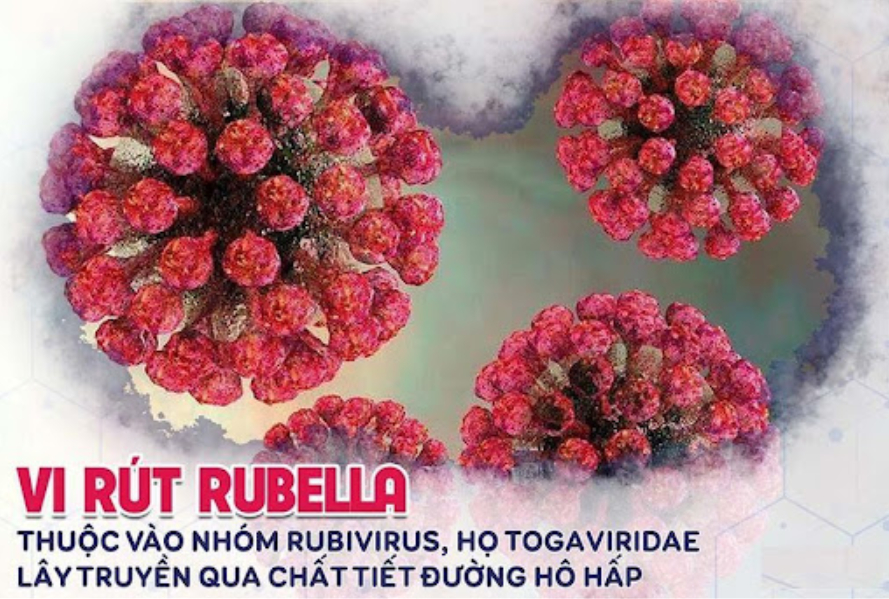 Rubella