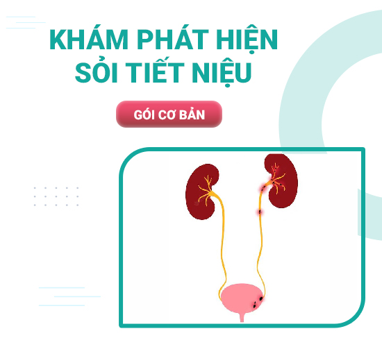 Gói khám phát hiện sỏi tiết niệu – Cơ bản